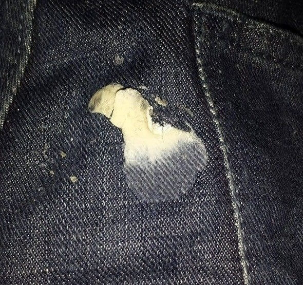 Use Ice to Remove Gum From Clothes