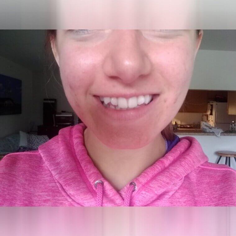 Whiten Your Teeth