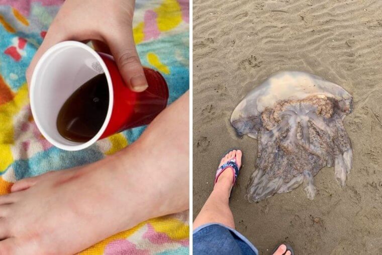 Combat Jellyfish Stings